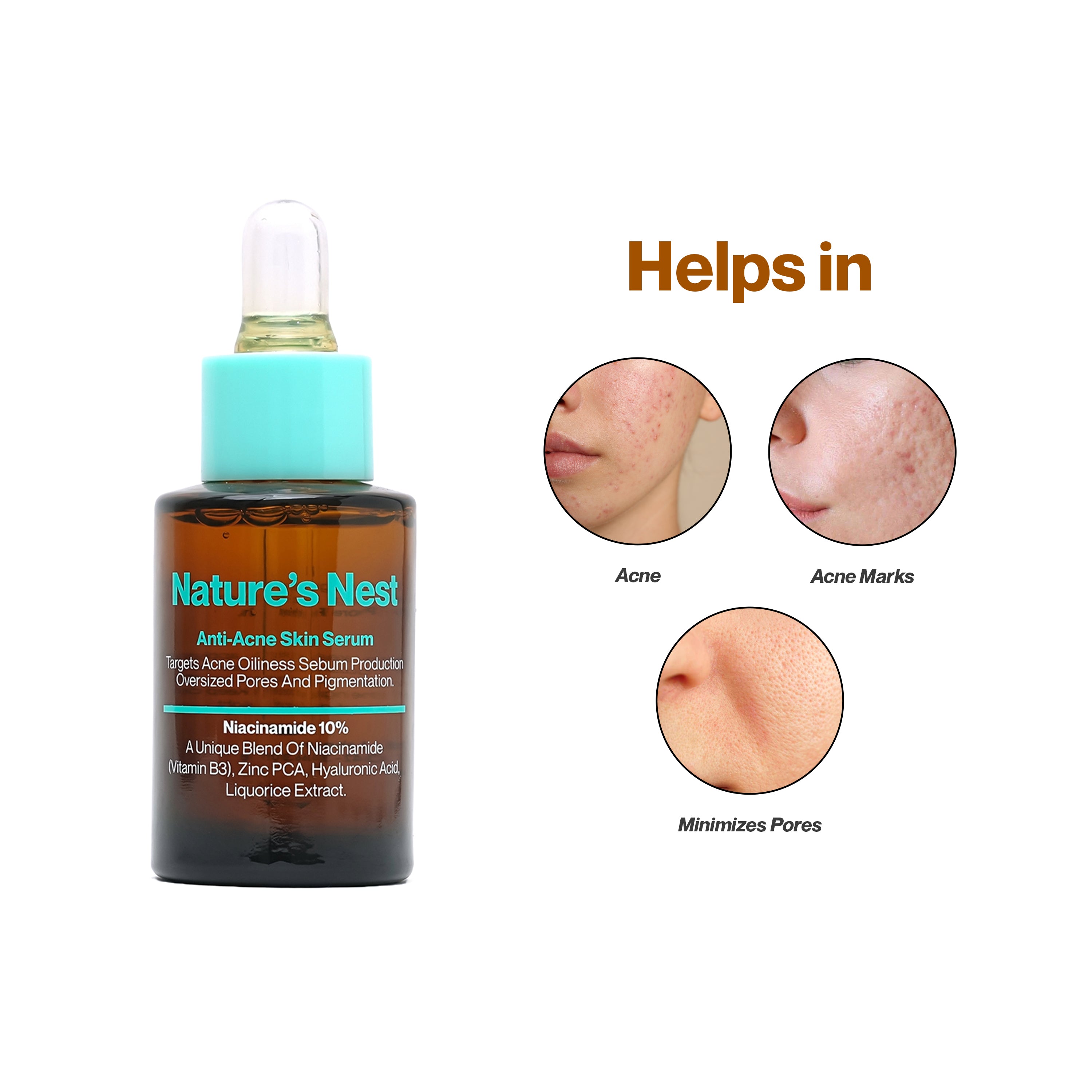 Nature's Nest- Anti Acne Skin Serum