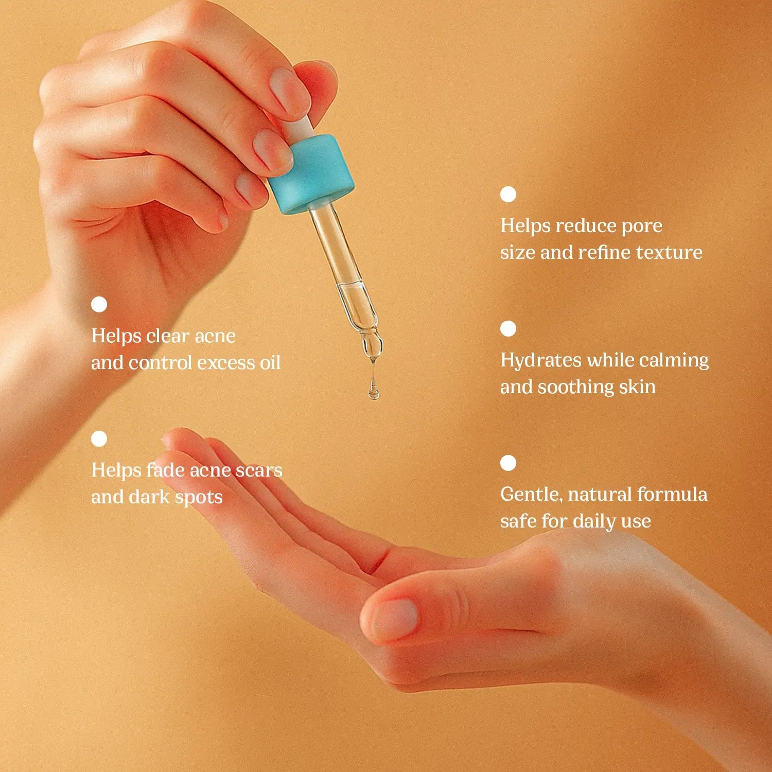 Nature's Nest- Anti Acne Skin Serum - Peace Skinvestment