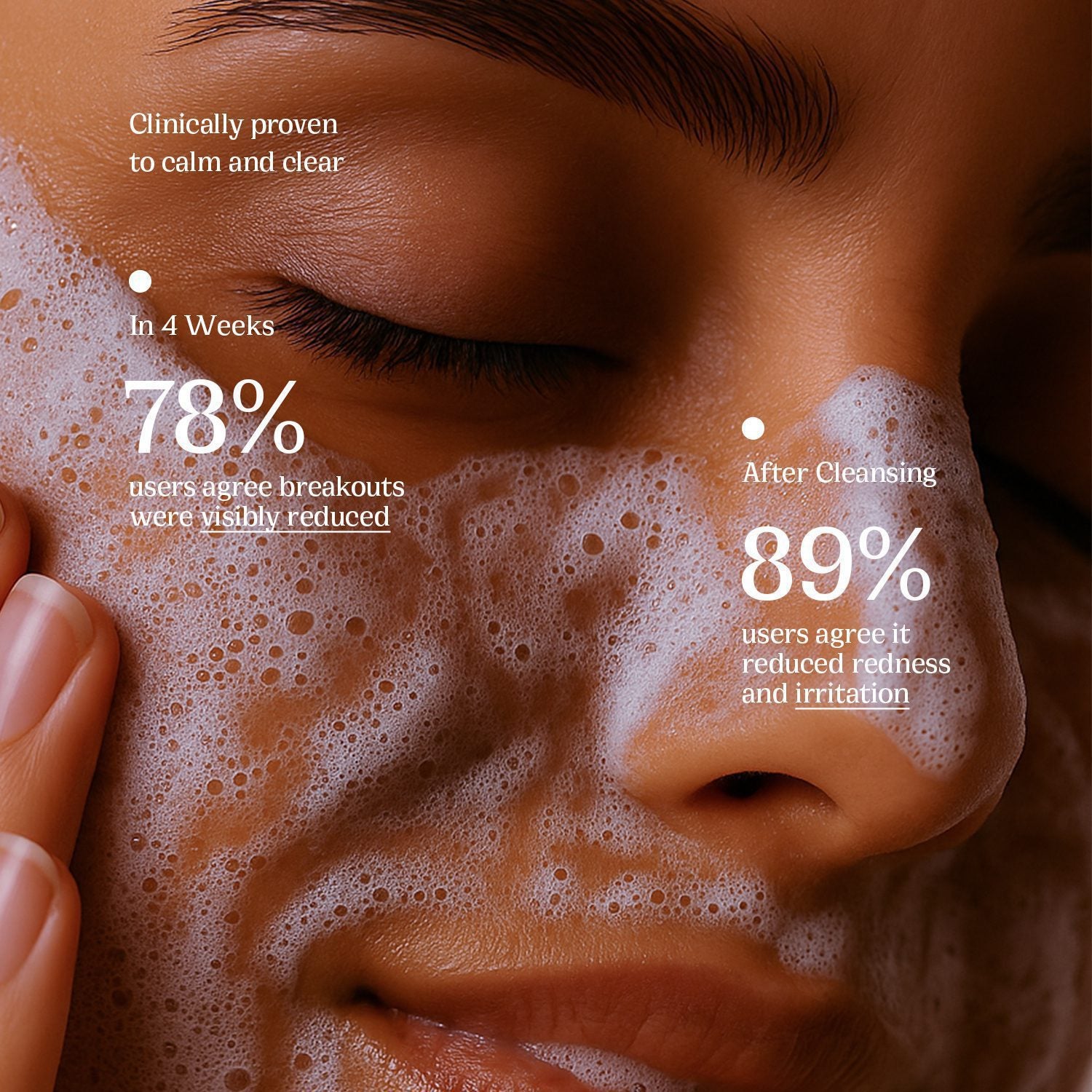 Pretty Pore Anti Acne Face Wash - Peace Skinvestment